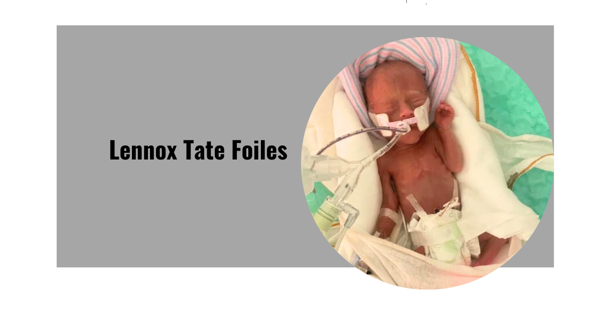 Lennox Tate Foiles